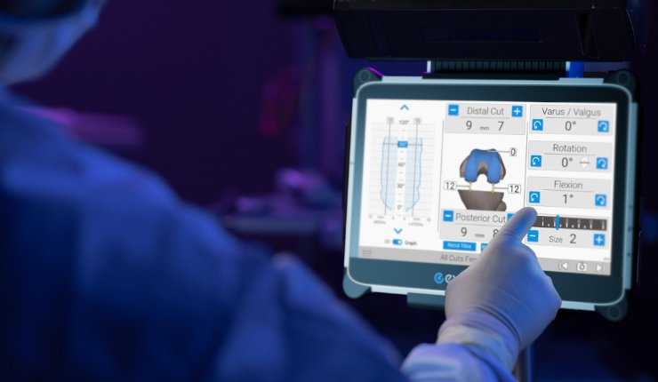 Exactech introduces new balancing technology for knee replacement patients