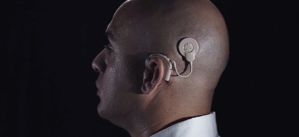 Case Study How A Cochlear Implant Helped Restore Hearing Med Tech Innovation Latest News For The Medical Device Industry