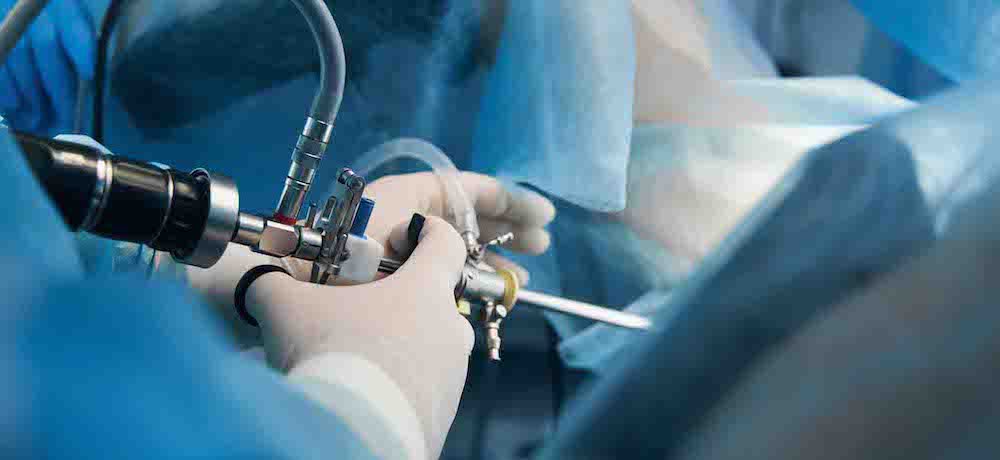 Laproscopic surgery system to aid quicker surgical training – TechToda…