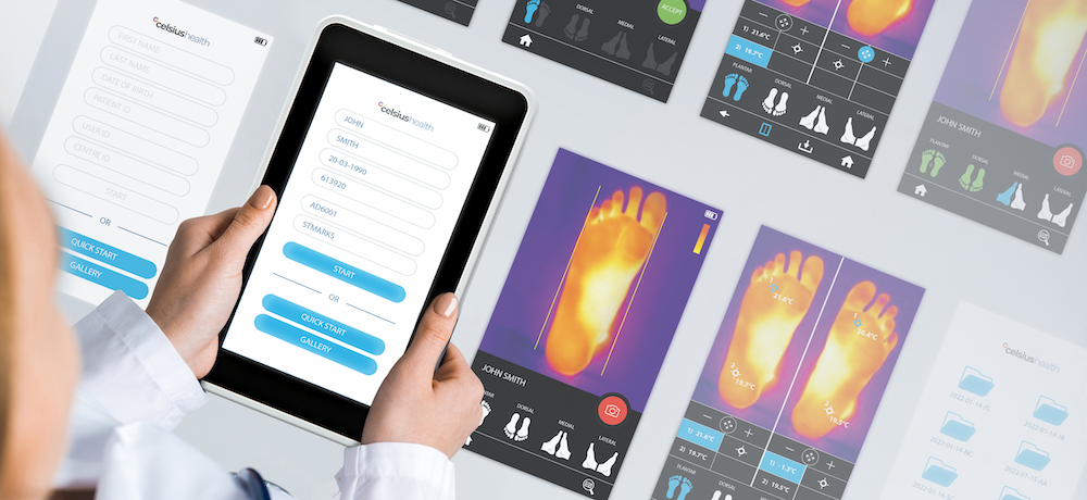 IDC creates thermology health thermal imaging device