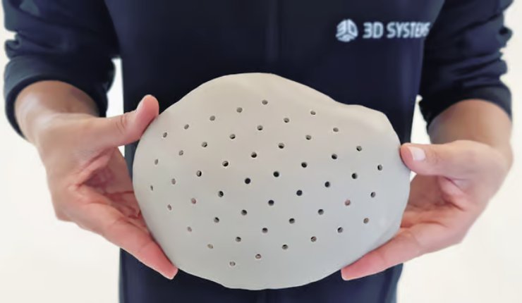 3D Systems announces FDA clearance for ‘world’s first’ 3D printed PEEK cranial implants